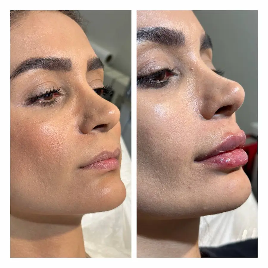 نمونه مراجعه‌کننده مرکز پوست و مو کلینک نگارین
